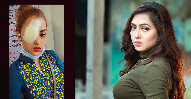লেন্স পরে বিপাকে তানহা