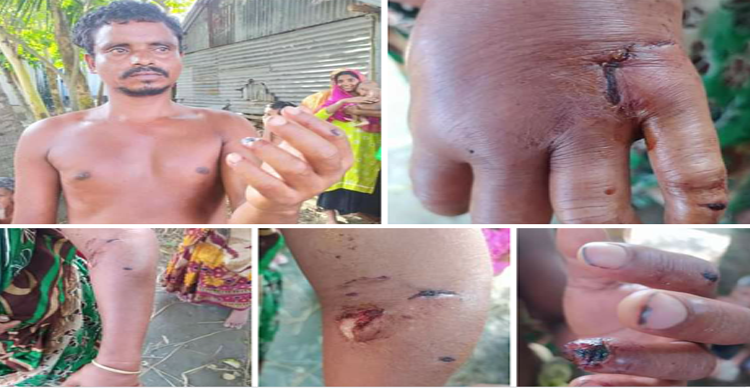 গোপালপুরে শিয়ালের কামড়ে ৫ ব্যক্তি আহত