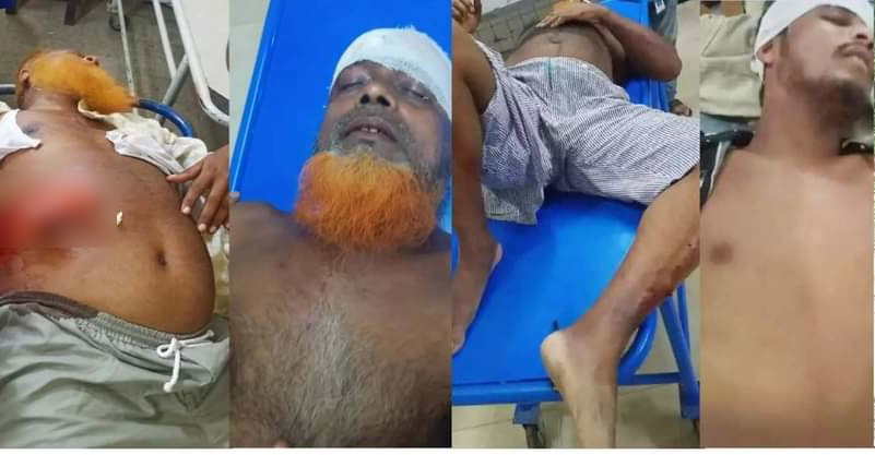 বেনাপোলে প্রতিপক্ষের হামলায়  আহত ৭