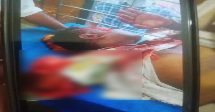 কালিহাতীতে  প্রকাশ্যে হাতের কব্জি কেটে ন